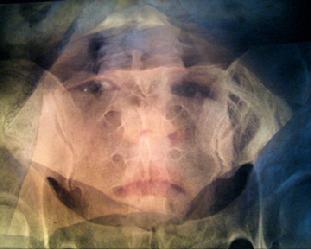Patient #24 image