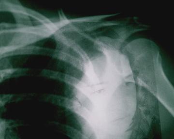 Patient #37 image